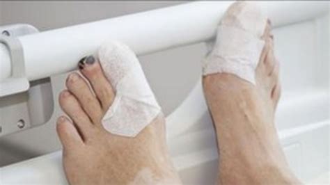 Feet First For Diabetes Patients Bbc News
