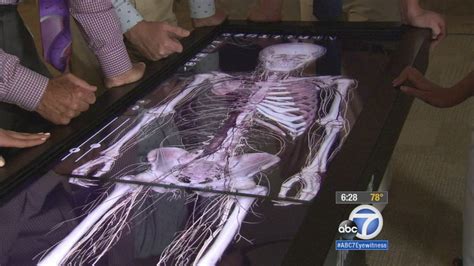 Virtual Dissection Table Replaces Cadavers At Pomona Graduate School