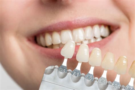 Dental Implants Vs Veneers Whats The Difference Maryland