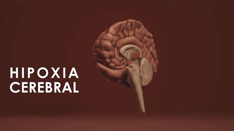 Que Es La Hipoxia Cerebral Todo Lo Que Debes Conocer Sobre La Hipoxia