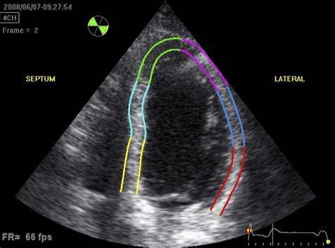 Echocardiography — Cardiology Institute
