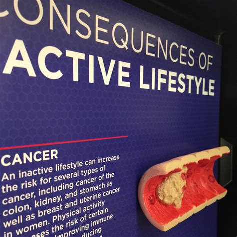 Inactive Lifestyle Consequences 3 D Display Health Edco
