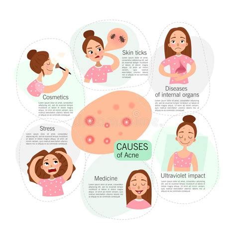 Types Of Acne Open Comedones Closed Comedones Inflammatory Acne