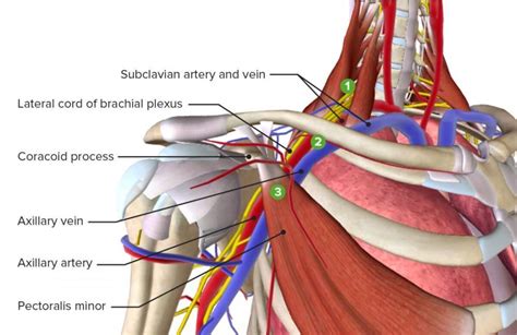 Thoracic Outlet Syndrome Explained Pittsburgh Physical Medicine And