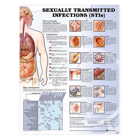 sexually transmitted infections stis anatomical chart 20 x 26