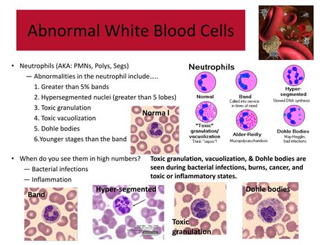 Abnormal White Blood Cell Count Chart