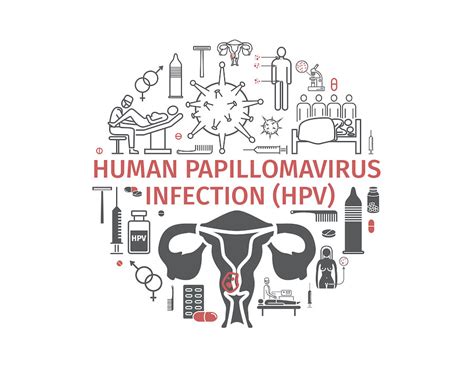 Human Papillomavirus Infection Hpv Vector Infographics Medical Associates Of Northwest Arkansas
