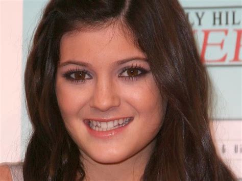 Kylie Jenner Got Lip Fillers At Just 15 After A Boy Made Fun Of Her