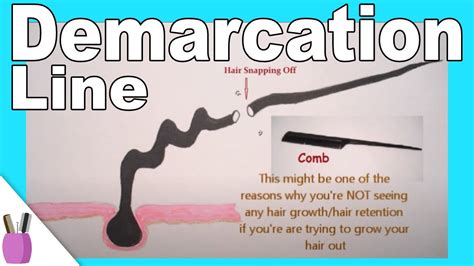 What Is Demarcation Line Point For Hair And Breakage Youtube