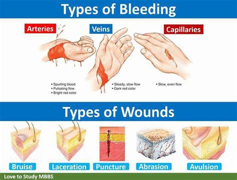 Types Of Wound Medizzy