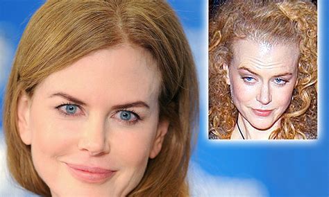 Nicole Kidman Admits To Having Used Botox After Years Of Questions