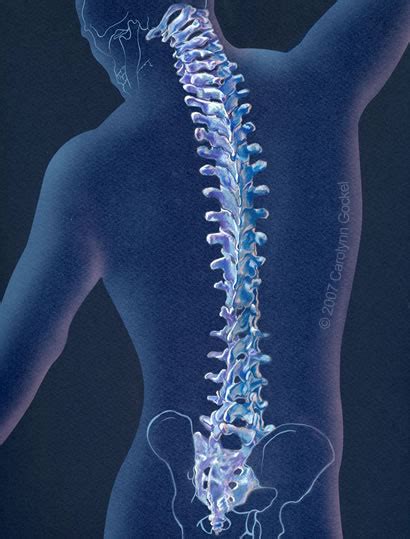 How Can You Treat Osteoarthritis Of The Spine