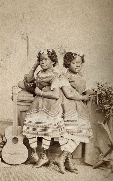 the millie christine sisters conjoined twins standing photograph c 1871 wellcome collection