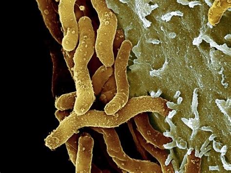 Helicobacter Pylori Bacteria Sem Photographic Print Science Photo