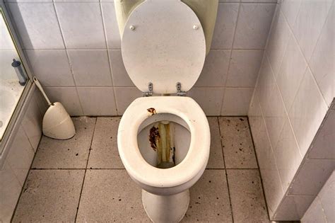 How To Remove Poop Stains From Toilet Homedude