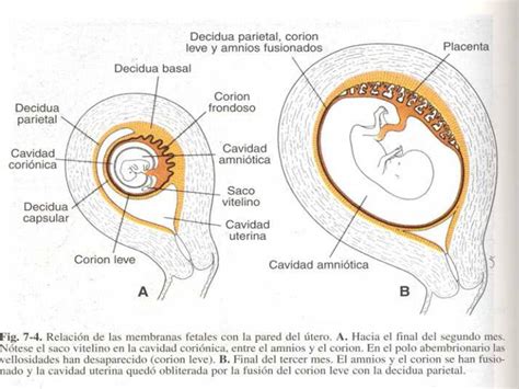 O Que é Placenta Grau 1