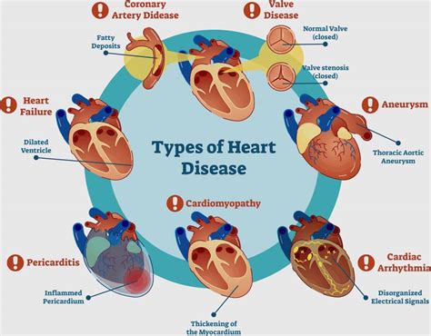 Getting To The Heart Of Cardiovascular Disease Through Testing