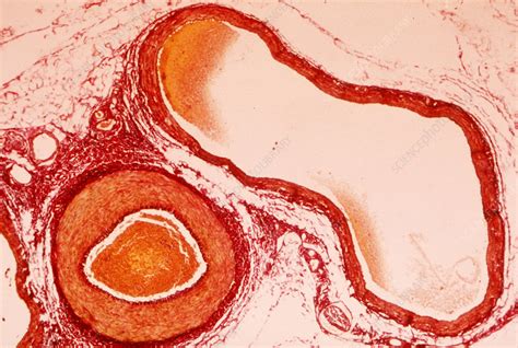 Artery And Vein Light Micrograph Stock Image C0208168 Science Photo Library