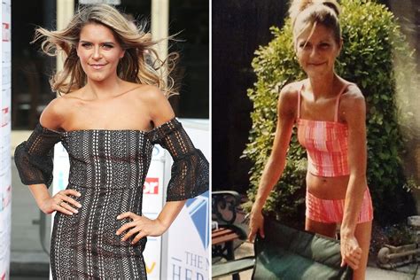 Ex Emmerdale Star Gemma Oaten Reveals Anorexia Battle Left Her 24 Hours From Death At 12