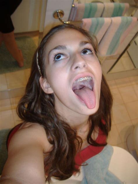 Braces And Tongue Out Girlconnoisseur