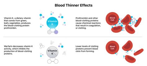Blood Thinners Types Side Effects And Drug Interactions