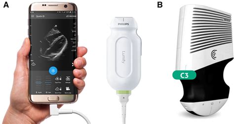 Handheld Echocardiography Circulation