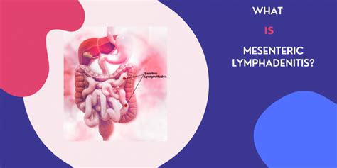 Mesenteric Lymphadenitis Symptoms Causes And Treatments Paybima