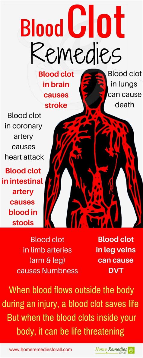 Blood Clots Stool In The Year 2023 The Ultimate Guide Stoolz