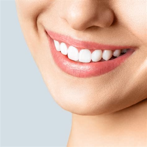 Erosione Dentale Sintomi E Trattamenti Consigliati Emoform