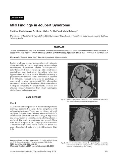 Pdf Mri Findings In Joubert Syndrome