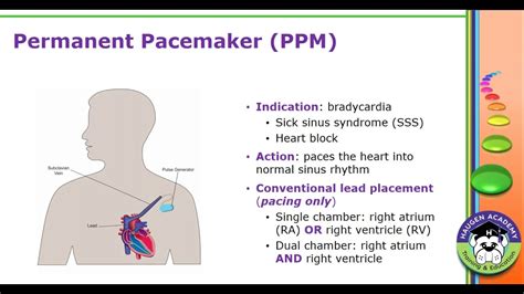 Hcgtv Webinar Pacemaker And Defibrillator Relationship Status Youtube