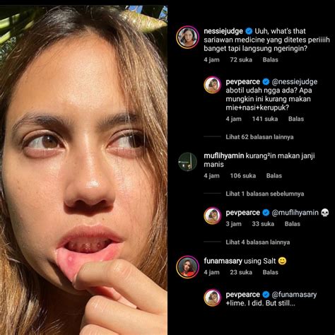 Pevita Pearce Unggah Foto Sariawan Dibanjiri Komentar Kocak Netizen Kurangi Makan Janji Manis