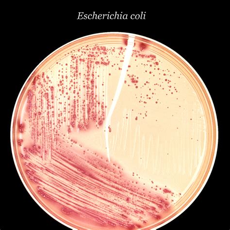 Free Picture Inoculated Macconkey Agar Culture Plate Colonial