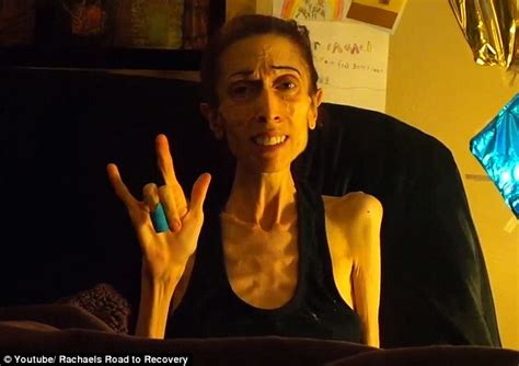 Anorexic Actress Rachael Farrokh Thanks The Public For Fundraising K Daily Mail Online