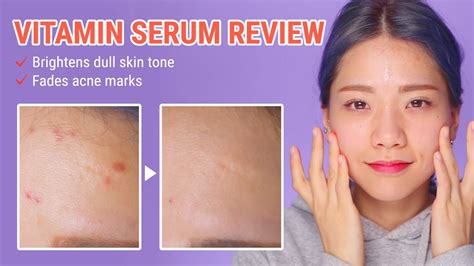 How To Fade Acne Scars In Just 2 Weeks By Wishtrend Pure Vitamin C 215 Advanced Serum Youtube