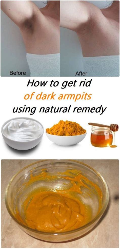 How To Get Rid Of Dark Armpits Using Natural Remedy List Of Beauty
