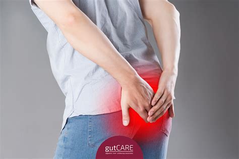 A Pain In The Butt Possible Causes For Hemorrhoids Thumbnail GUTCARE