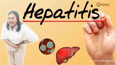 Hari Hepatitis Sedunia Juli Kenali Penyakit Hepatitis Gejala Dan Jenisnya