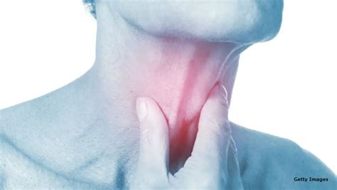 sore throat pharyngitis causes symptoms and treatment healthtian