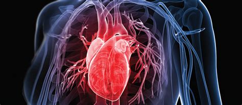 Managing Patients With Critical Cardiac Conditions