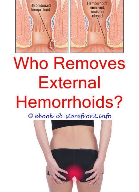 In this video we look holistically at hemorrhoids. Piles are usually very agonizing, however a little ...