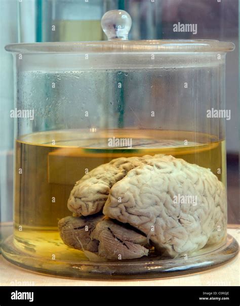 Real Human Brain In A Glass Jar Stock Photo Alamy