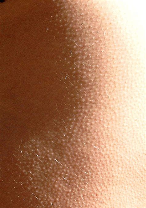Why Do We Get Goose Bumps How It Works Magazine