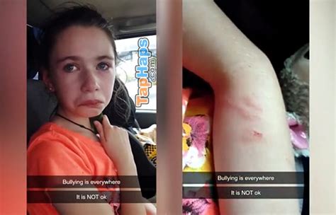special needs girl bleeding from school bully — mom pleads for action
