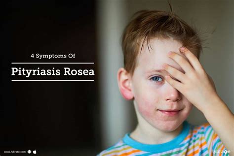 4 Symptoms Of Pityriasis Rosea By Dr Nitin Jain Lybrate