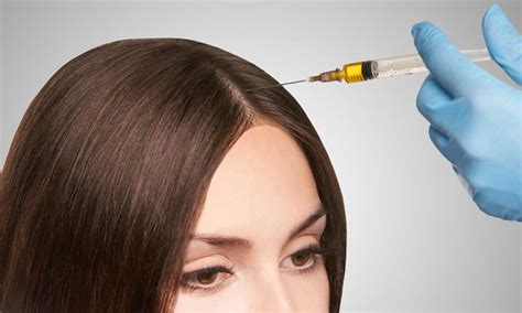 Oral cyclosporine for the treatmtnt of alopecia areata. How PRP Treatment Helps Women To Keep Their Hair Healthy ...