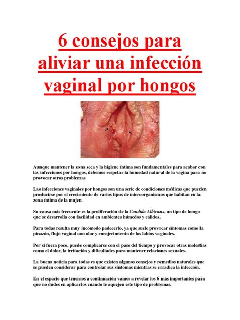 6 Consejos Para Aliviar Una Infección Vaginal Por Hongos Infección