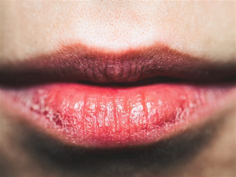 How To Get Rid Of Dry Chapped Lips Cookist