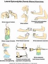 Images of Exercise Program With Broken Arm