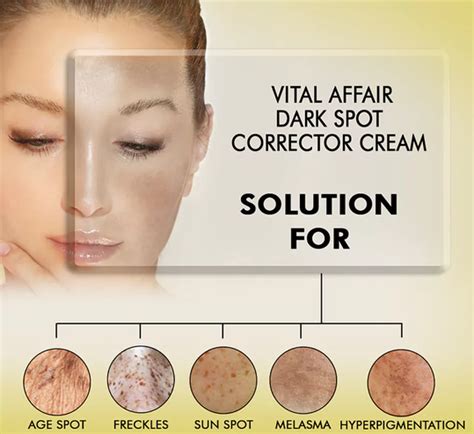 Dark Spot Corrector Cream Vital Affair